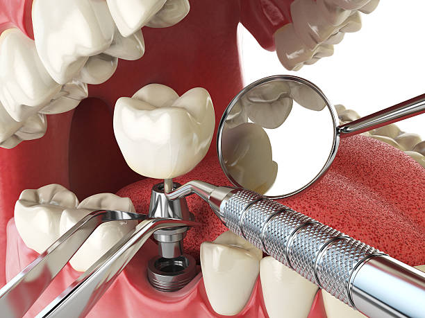 Best Emergency Cosmetic Dentistry in San Gabriel, CA